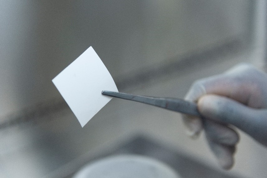 Innovative woundhealing technique using amniotic membrane Innovative