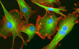 Co-transplantation of umbilical cord tissue MSCs 