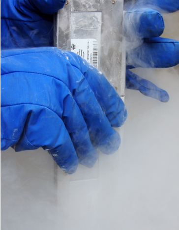 Amniotic membrane transplantation 