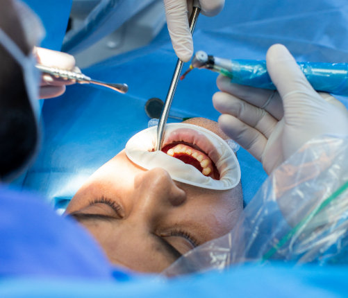 Benefits of AmnioDental