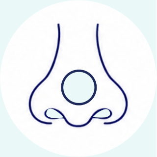 Nasal septum perforation repair 