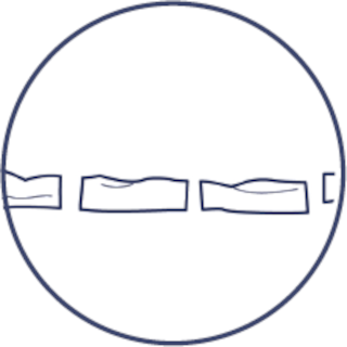 Cord Tissue Is Cut