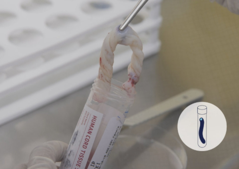 Umbilical Cord Tissue