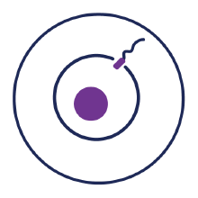 Severe male factor (SMF) infertility