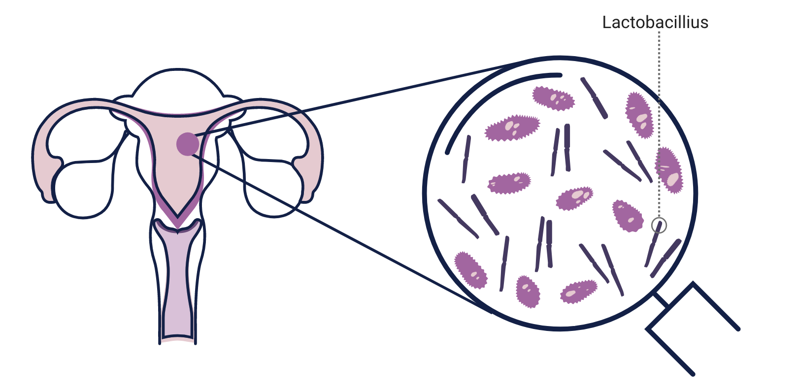 Understanding Endometrial Testing in IVF