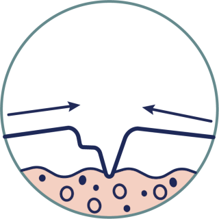 Tissue repair and recovery 
