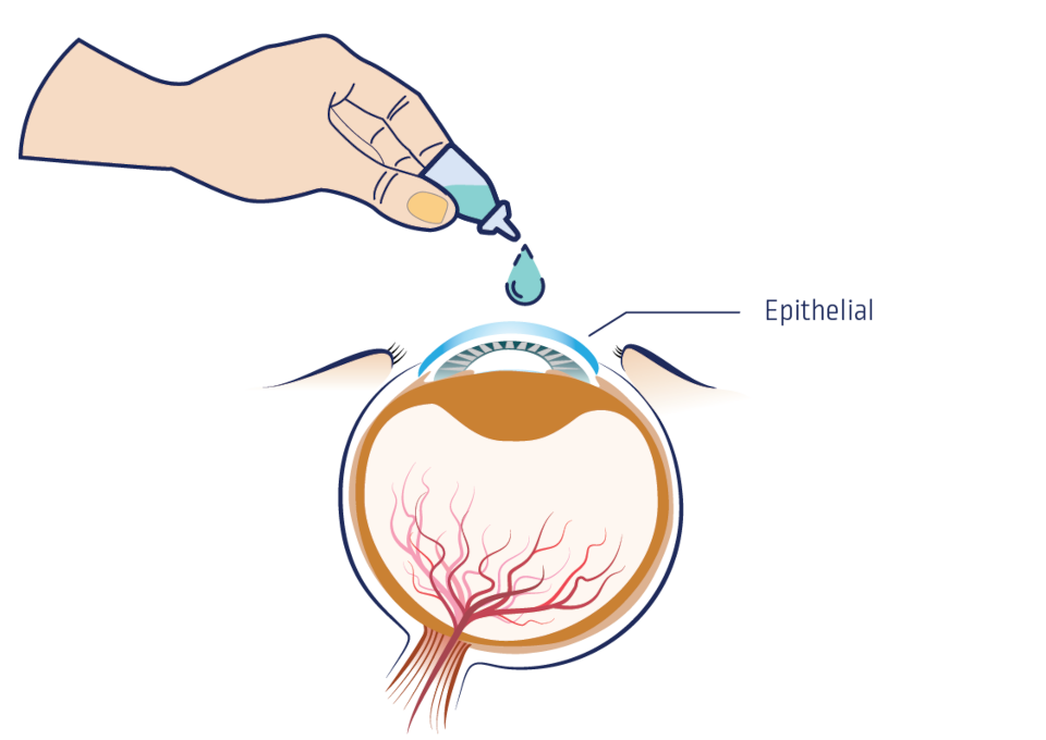 What Is OptiSerum?