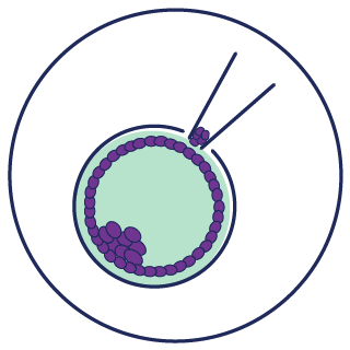 Embryo Biopsy