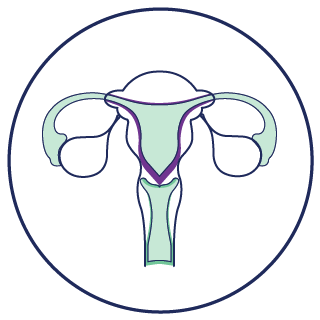 Embryo Transfer