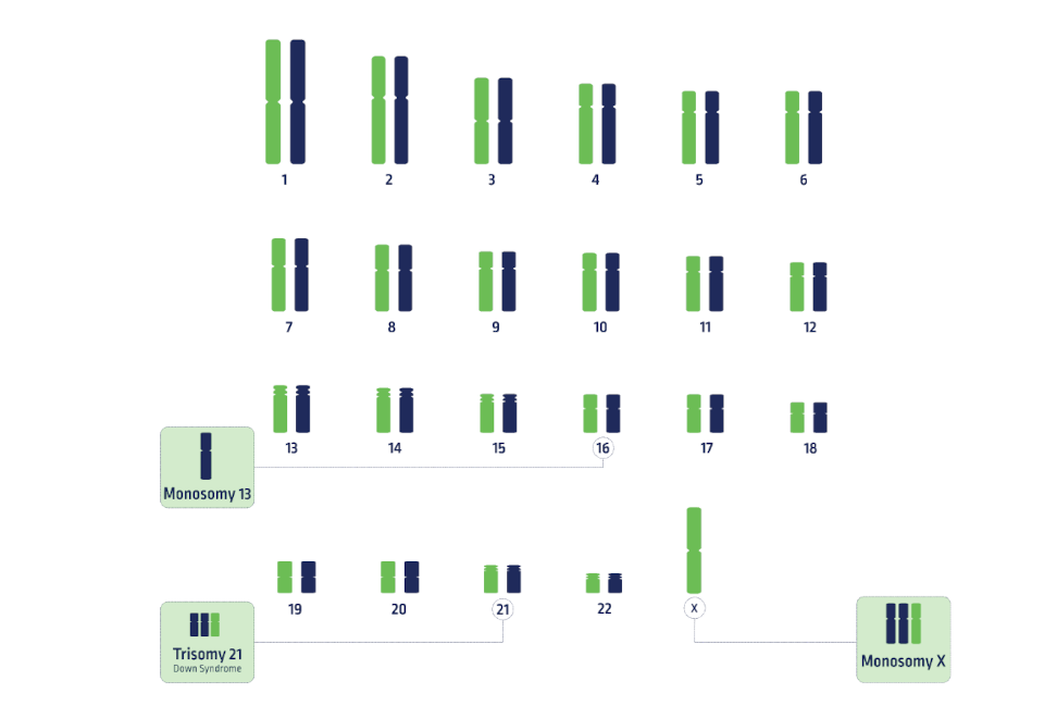 Understanding Chromosomal Abnormalities